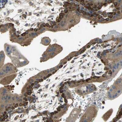 Immunohistochemistry-Paraffin: DIAPH-2 Antibody [NBP1-85217]