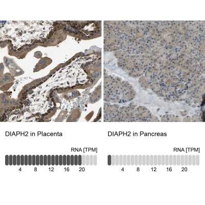 Immunohistochemistry-Paraffin: DIAPH-2 Antibody [NBP1-85217]