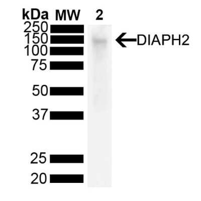 Western Blot: DIAPH-2 Antibody (V78 P3C10-D3) [NBP3-18260]