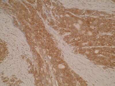 Immunohistochemistry: DIAPH-2 Antibody (V78P3C10*D3) - BSA Free [NBP2-50229]