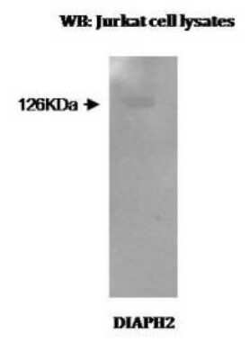 Western Blot: DIAPH-2 Antibody (V78P3C10*D3)BSA Free [NBP2-50229]