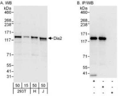 Western Blot: DIAPH-2 Antibody [NB600-280]