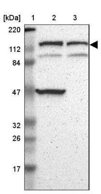 Western Blot: DIAPH-2 Antibody [NBP1-85217]