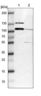 Western Blot: DIAPH-2 Antibody [NBP1-85217]