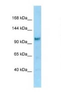 Western Blot: DIAPH-2 Antibody [NBP1-98364]