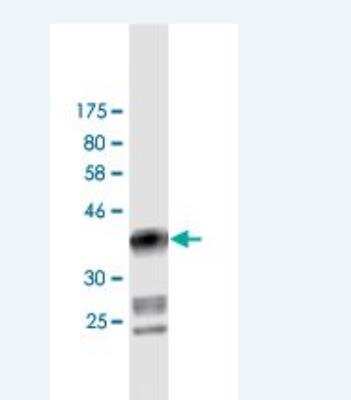 Western Blot: DIAPH1 Antibody (1A8) [H00001729-M02]