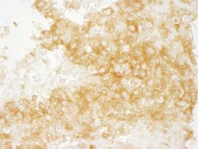 Immunohistochemistry: DIAPH1 Antibody [NB600-231]