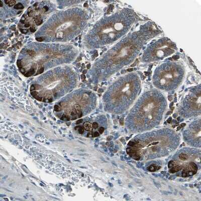 Immunohistochemistry-Paraffin: DIAPH1 Antibody [NBP1-85246]