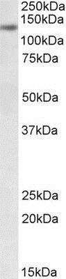 Western Blot: DIAPH1 Antibody [NBP1-47202]