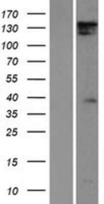 Western Blot: DIAPH1 Overexpression Lysate [NBP2-09814]