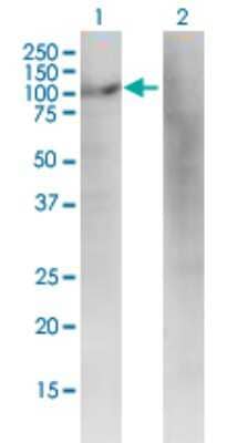 Western Blot: DIAPH3 Antibody (4D5) [H00081624-M01]