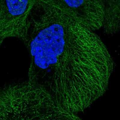 Immunocytochemistry/ Immunofluorescence: DIAPH3 Antibody [NBP2-58613]