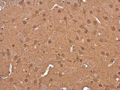 Immunohistochemistry-Paraffin: DIAPH3 Antibody [NBP3-12956]