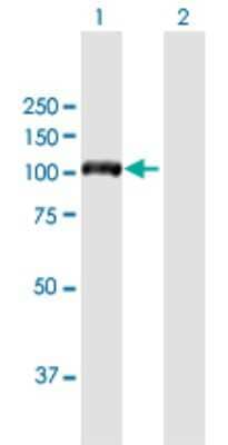 Western Blot: DIAPH3 Antibody [H00081624-B01P]