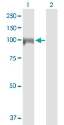 Western Blot: DIAPH3 Antibody [H00081624-D01P]