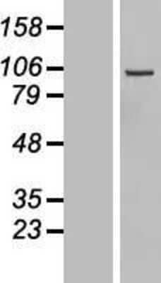 Western Blot: DIAPH3 Overexpression Lysate [NBL1-09883]