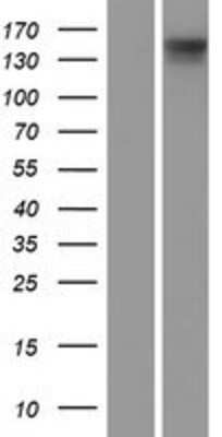 Western Blot: DIAPH3 Overexpression Lysate [NBP2-09237]