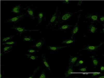 Immunocytochemistry/ Immunofluorescence: DIDO1 Antibody (3B1) [H00011083-M04]