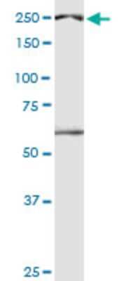 Western Blot: DIDO1 Antibody (3B1) [H00011083-M04]