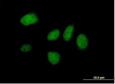 Immunocytochemistry/ Immunofluorescence: DIDO1 Antibody [H00011083-B01P]