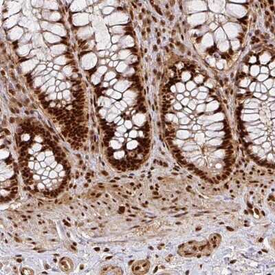 Immunohistochemistry-Paraffin: DIDO1 Antibody [NBP2-33269]