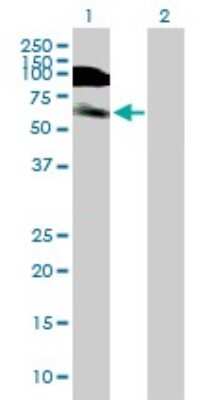 Western Blot: DIDO1 Antibody [H00011083-B01P]