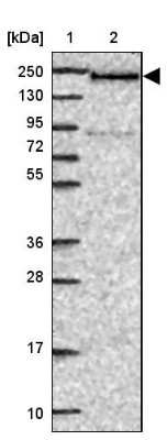 Western Blot: DIDO1 Antibody [NBP2-33269]