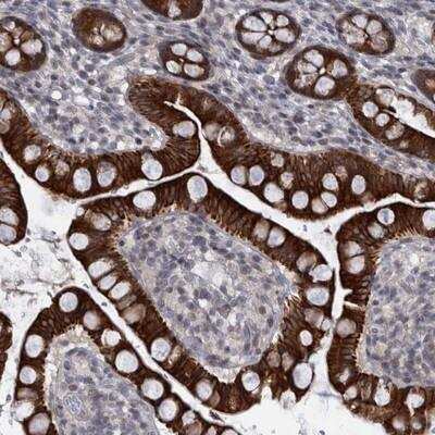 Immunohistochemistry-Paraffin: DIEXF Antibody [NBP1-88480]