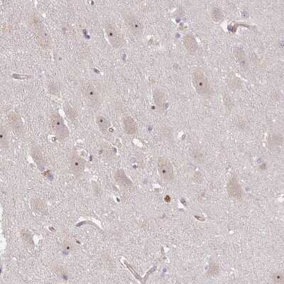 Immunohistochemistry-Paraffin: DIMT1L Antibody [NBP2-30659]