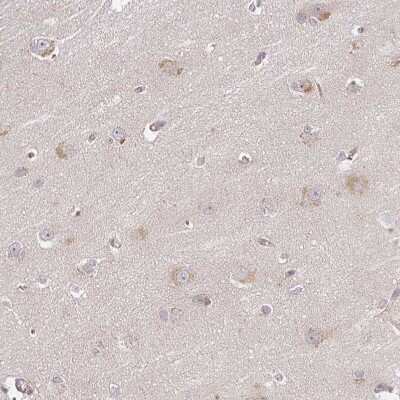 Immunohistochemistry-Paraffin: DIMT1L Antibody [NBP2-30659]