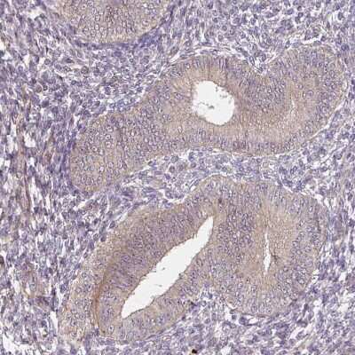 Immunohistochemistry-Paraffin: DIMT1L Antibody [NBP2-30659]