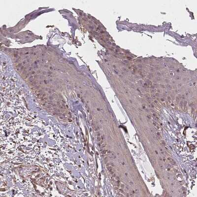 Immunohistochemistry-Paraffin: DIMT1L Antibody [NBP2-30659]