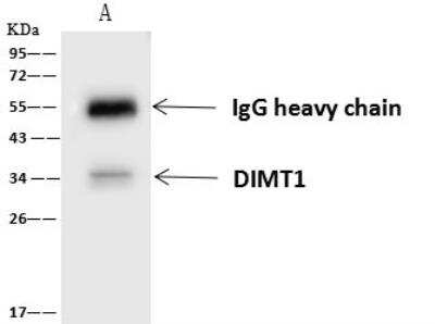 Immunoprecipitation: DIMT1L Antibody [NBP2-97740]