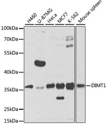 Western Blot: DIMT1L AntibodyBSA Free [NBP2-92811]