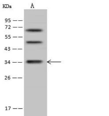 Western Blot: DIMT1L Antibody [NBP2-97740]