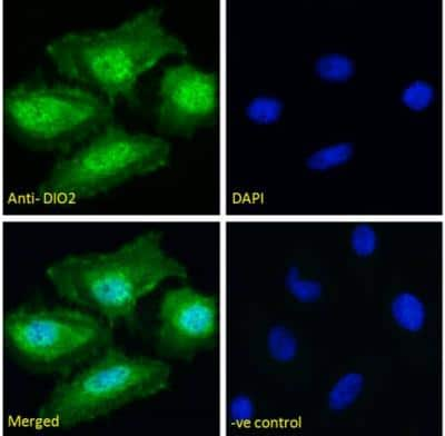 Immunocytochemistry/ Immunofluorescence: DIO2 Antibody [NBP1-00178]