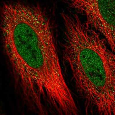 Immunocytochemistry/ Immunofluorescence: DIO2 Antibody [NBP2-56543]