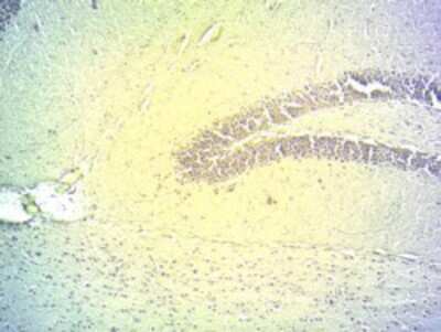 Immunohistochemistry-Frozen: DIO2 Antibody [NBP1-00178]