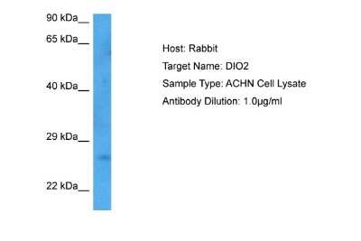 Western Blot: DIO2 Antibody [NBP2-84790]