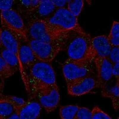 Immunocytochemistry/ Immunofluorescence: DIO3 Antibody [NBP3-17201]