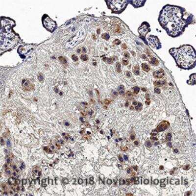 Immunohistochemistry-Paraffin: DIO3 Antibody [NB110-96414]