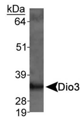 Western Blot: DIO3 Antibody [NB110-96414]