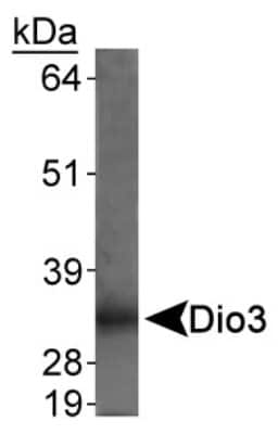 Western Blot: DIO3 AntibodyBSA Free [NBP1-05767]