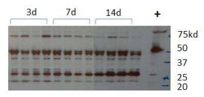 Western Blot: DIO3 AntibodyBSA Free [NBP1-05767]
