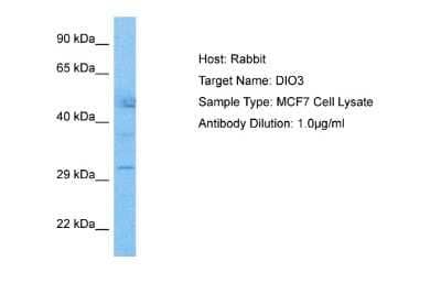 Western Blot: DIO3 Antibody [NBP2-86616]