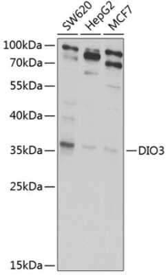 Western Blot: DIO3 AntibodyBSA Free [NBP2-92482]