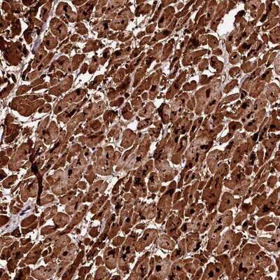 Immunohistochemistry-Paraffin: DIP13B Antibody [NBP2-14303]