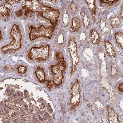 Immunohistochemistry-Paraffin: DIP13B Antibody [NBP2-14304]