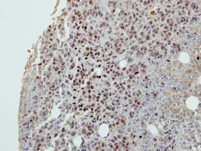 Immunohistochemistry-Paraffin: DIP13B Antibody [NBP2-16164]