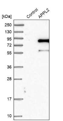 Western Blot: DIP13B Antibody [NBP2-14303]